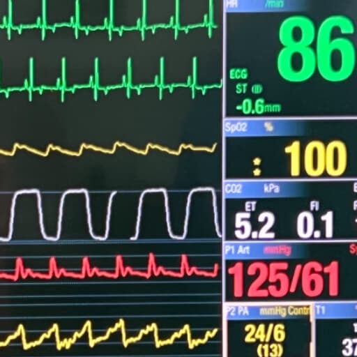 Veterinary anaesthesia specialist monitoring a patient during surgery